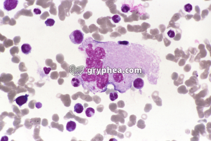 Mégacaryocyte dans la moelle osseuse x200 - gryphea.org